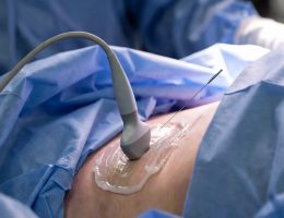 Abdominal Sepsis: Tanıdan Tedaviye Güncel Yaklaşım