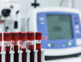 Düzeltilmiş Kalsiyum Hesaplama