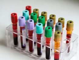 Hangi Tüp, Hangi Test? Kapsamlı Kan Alma Kılavuzu