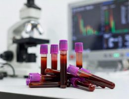 Tam Kan Sayımı (Hemogram): Parametreler, Referans Aralıkları ve Klinik Yorum